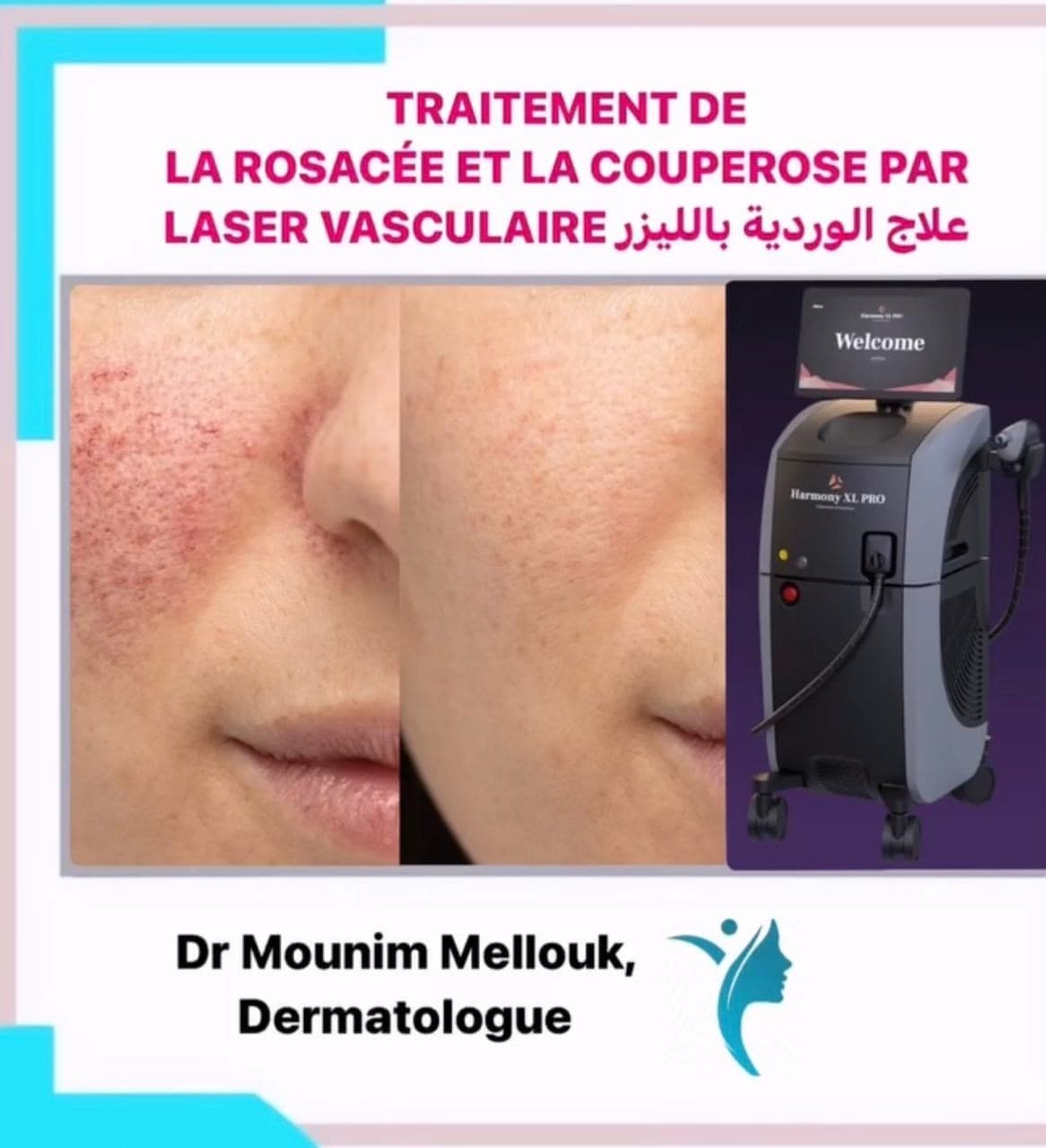 Taches brunes et mélasma : quelles solutions à Tanger
